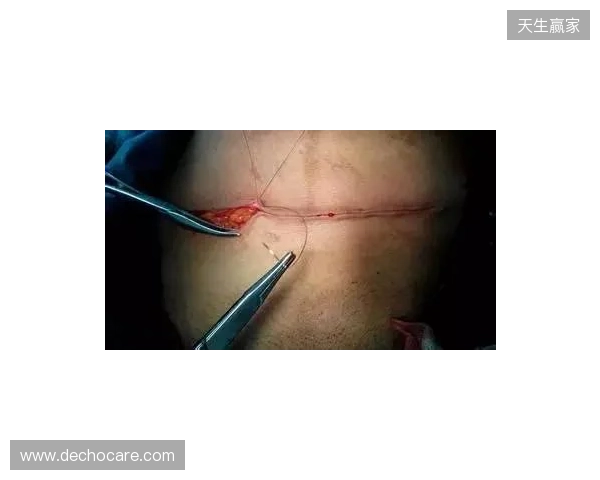 广州豹官方：杨浩眉弓伤口缝合30余针，预计5-7天后拆线